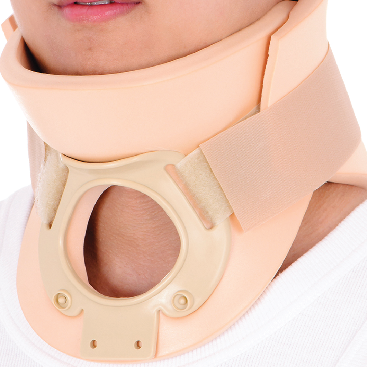 PHILADELPHIA COLLAR TRACHEATOMY